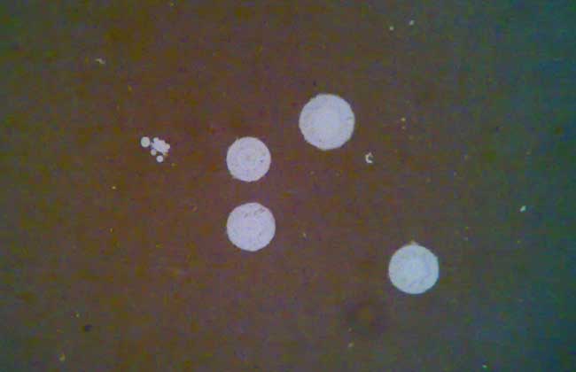 念珠菌是霉菌吗？