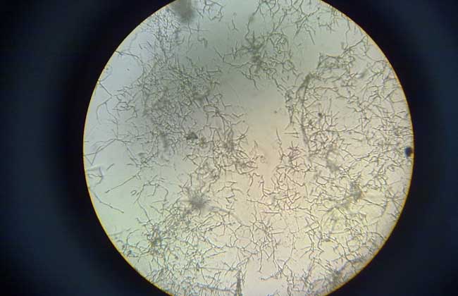 放线菌属于细菌吗？