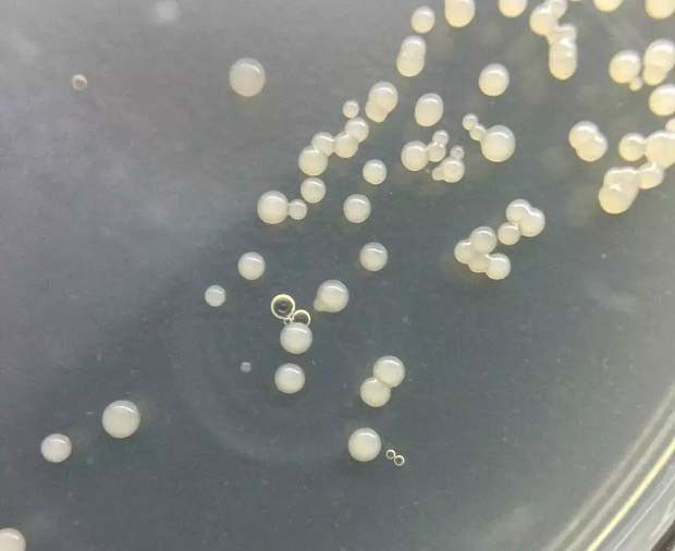 什么是真菌的繁殖体？