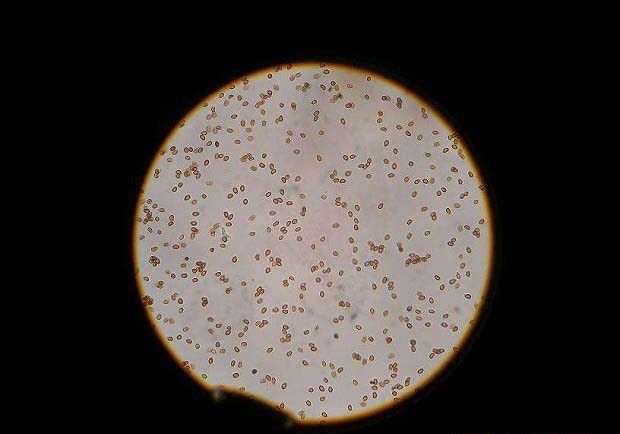 灵芝菌种分离：孢子分离法介绍
