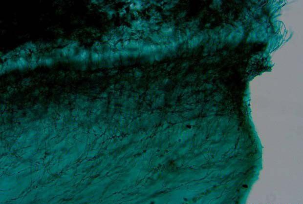 种植如何防治青霉?